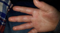 What do you think this is? *Gross picture, sorry*