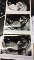 12 week gender guesses