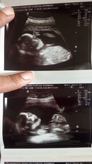 Pregnancies due April 2018