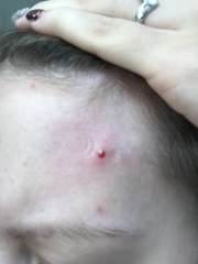 When can I squeeze this?