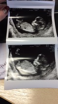 12 week gender guesses