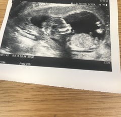 Boy or girl?
