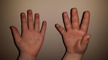 What do you think this is? *Gross picture, sorry*