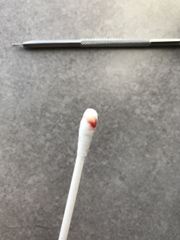 When can I squeeze this?