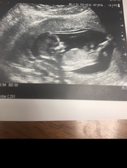 Boy or girl?