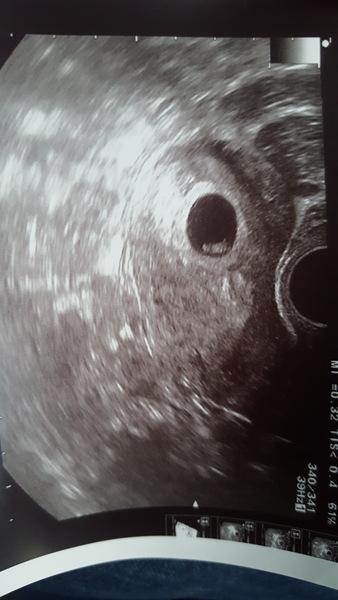 September babies 2018