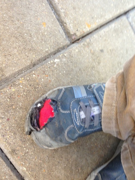 My child had a horrific accident on an escalator