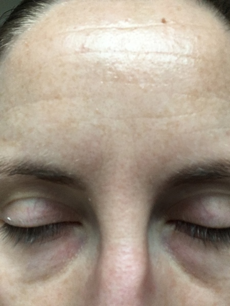 Ok so this is the horrible reality of my face