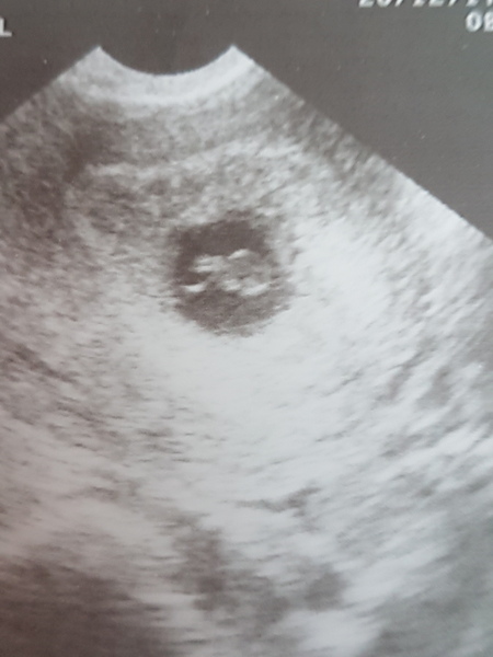 Does this scan look normal? Low resolution image