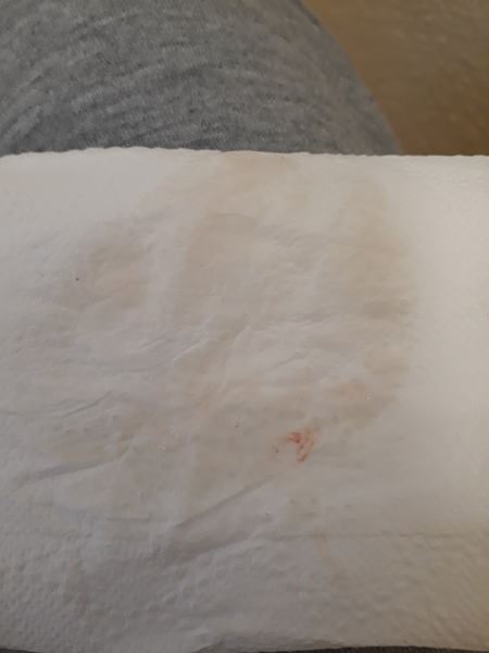 TMI hubby had vasectomy so what could this be?