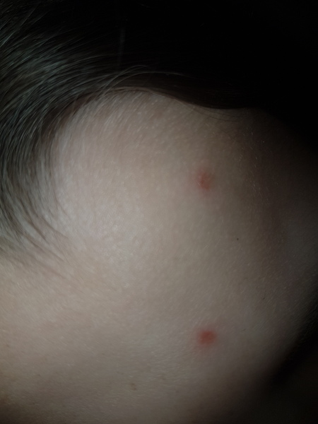 Help with spots.. ..