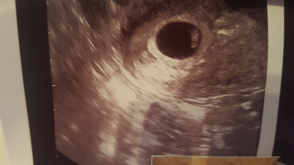 September Babies 2018 #2
