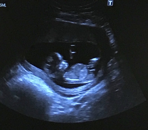 Just for fun :) any gender guesses?