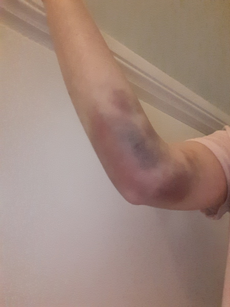 August 2018 #3 - booking appointments and 12 week scans!