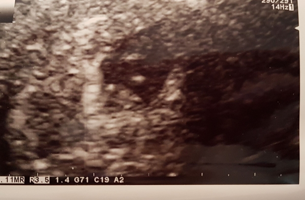 September 2018 #2: testing and symptom-analysing