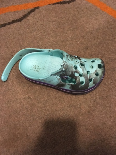 My child had a horrific accident on an escalator