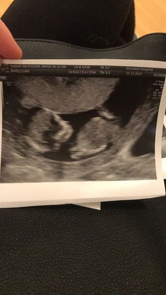 Am I having a girl or a boy?