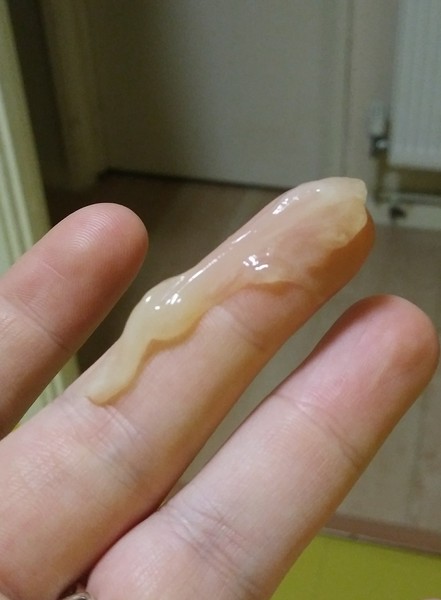 2nd pregnancy, loss of mucus plug (tmi pic included) is labor likely soon being 2nd baby???