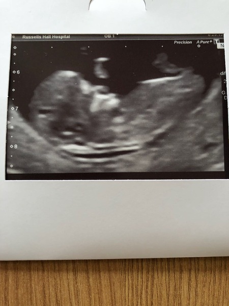 Gender Guess... where is the nub?!