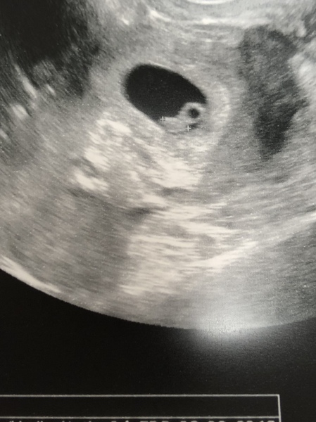 September babies 2018