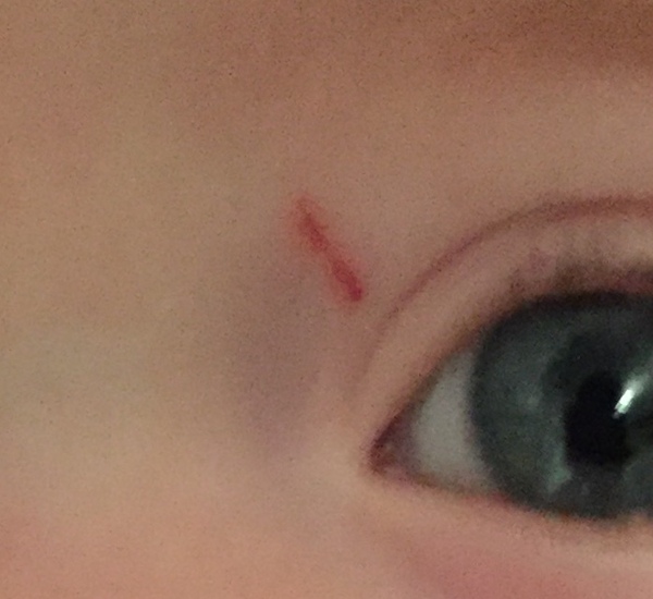 Baby scratched at nursery - AIBU...?
