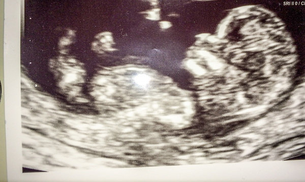 Guess our baby's gender!