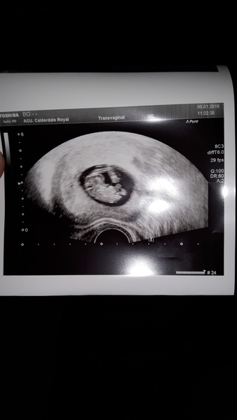 IVF - A supportive group of ladies at various stages of the ivf journey.