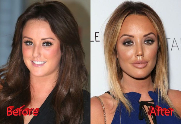To wonder how you can have £50k of facial surgery and not have some sort of identity crisis?