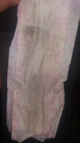 very tmi picture 30 weeks