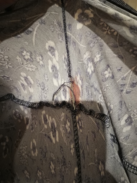 Bleeding after sex (Pics attached) Sorry if TMI.