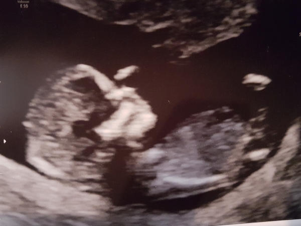 Any guesses??? 12 week scan