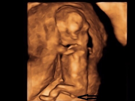 Guess our baby's gender!