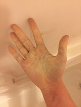 Blue Veins Very Visible In Palms?