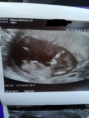 August 2018 #3 - booking appointments and 12 week scans!