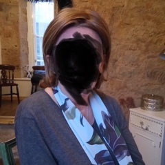 Hair loss support thread