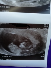 August 2018 #3 - booking appointments and 12 week scans!