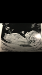 Any gender guesses