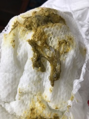 Baby poo *sorry pic inside*
