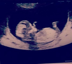 Gender guesses?!