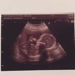 Gender guesses?!