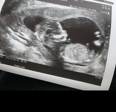 Boy or girl guesses please