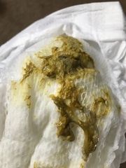 Baby poo *sorry pic inside*