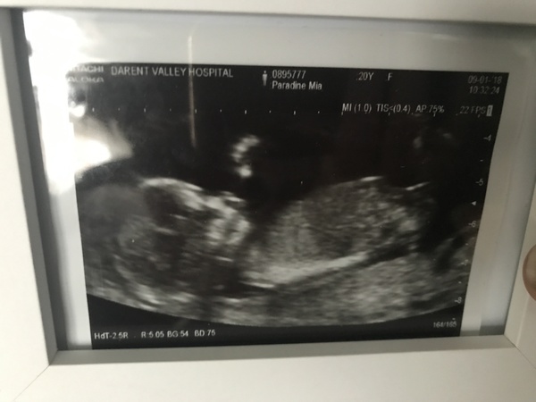 Any last guesses I have gender scan tomorrow morning!