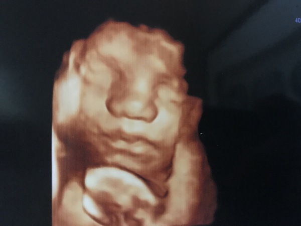 Babies due May 2018