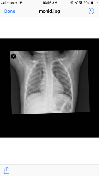 children's x-rays