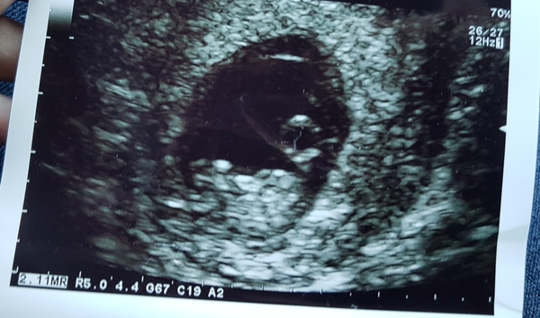 September 2018: #3! Early scans and booking in... it's all getting very real!