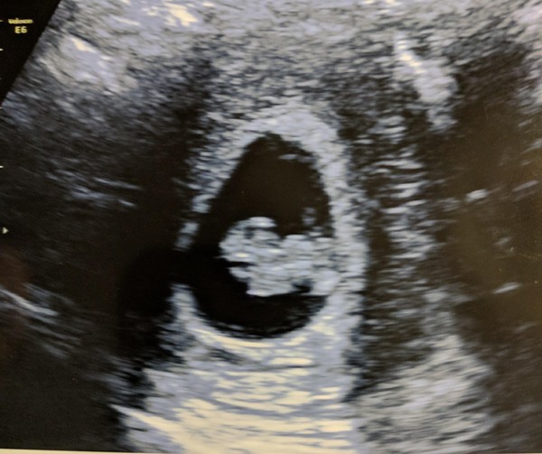 September Babies 2018 #2