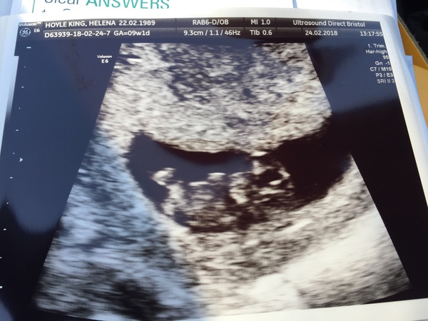 September Babies 2018 #2