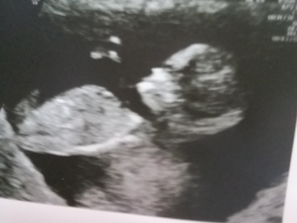 September 2018: #3! Early scans and booking in... it's all getting very real!