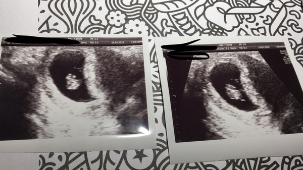 September Babies 2018 #2
